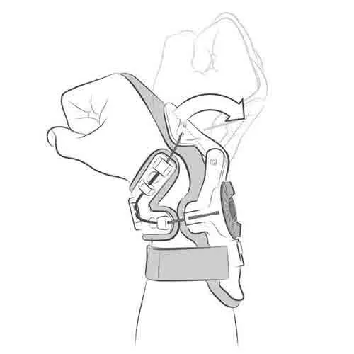 Mobius - X8 Grey Wrist Brace